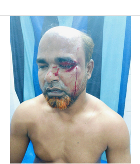 শহীদ মিনারে ফুল দিয়ে ফেরার পথে ছুরিকাহত নাগরিক ঐক্যের আহ্বায়ক